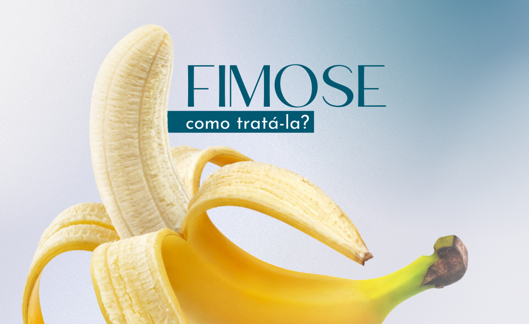 Fimose