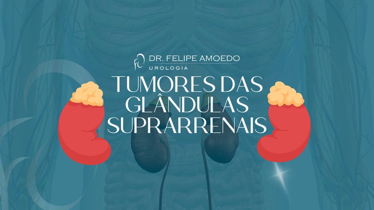 Adrenalectomia: A Solução Definitiva para Tumores das Glândulas Suprarrenais